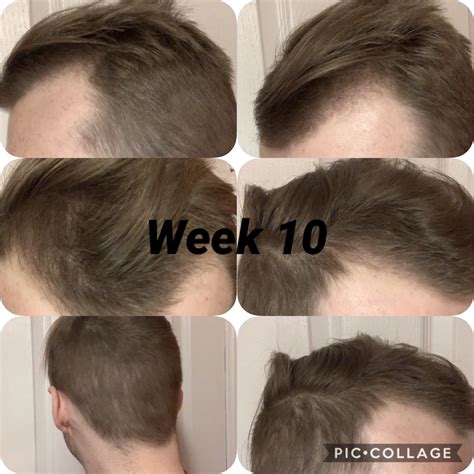 The surprising science-backed tips found on r/tressless this week 2