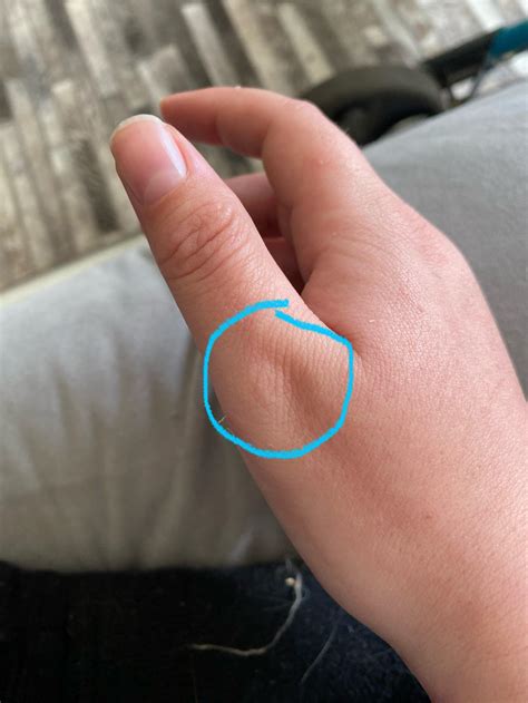 Help pushing with unstable thumb joints- are there any splints? : r