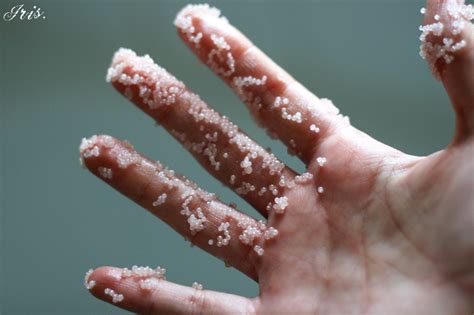 Skin Diseases Holes