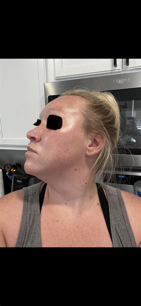 Do you see progress? : r/Skincare_Addiction