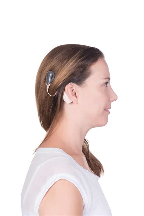 Cochlear Implants Overview | Arizona Hearing Specialists