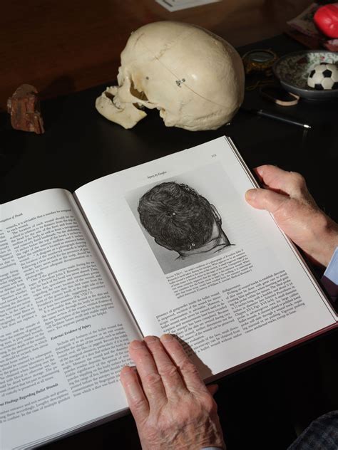 The Hidden Clues In The Laci Peterson Autopsy Pictures Image 20