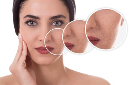 steps  cure dry skin  face overnight dabble  beauty