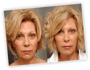 SILK омолаживающее масло | Face cream, Anti aging cream, Beauty news