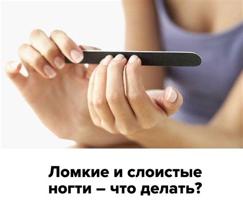 Ломкие и слоистые ногти – что делать? - Студия красоты "NailsProfi"