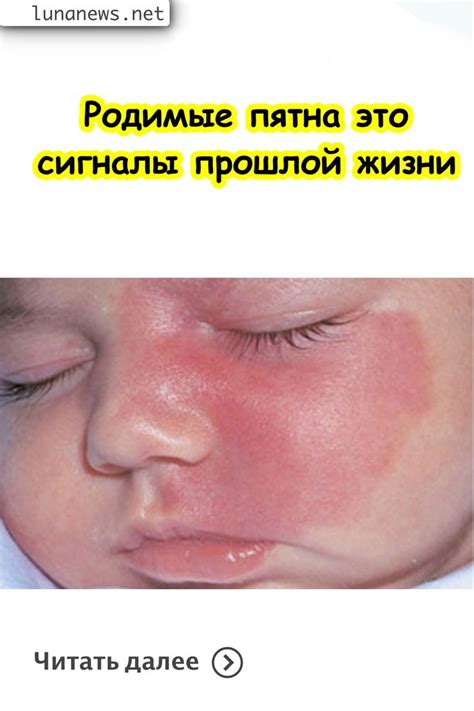 Родимые пятна это сигналы прошлой жизни | Прошлая жизнь, Фотографии ...