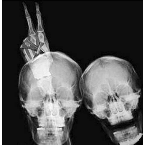 17 обалденных рентгеновских фотографий, на которых «внутренний мир ...