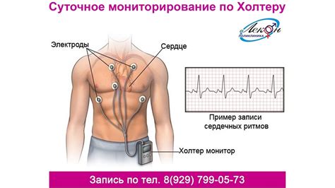 Холтер - YouTube