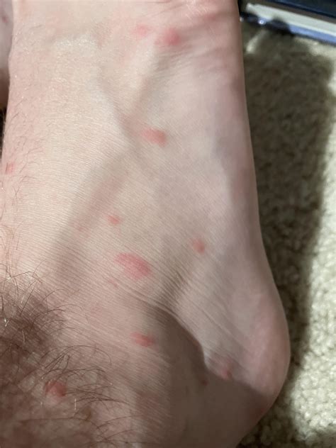 What are these? They started appearing about 3 or so days ago. They are