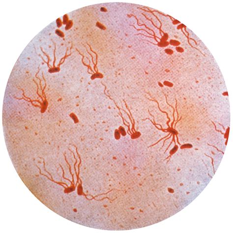 typhoid fever - Students | Britannica Kids | Homework Help