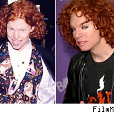 Carrot Top Before And After Body