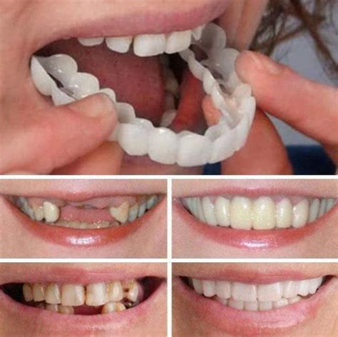 Magic Teeth Brace – moderntrendystore