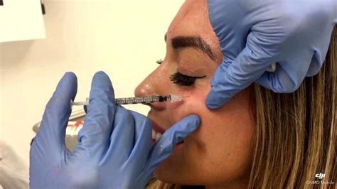 how to get botox covered by insurance