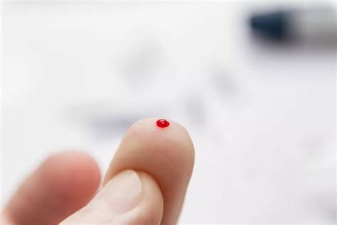 Figer Prick Blood Tests