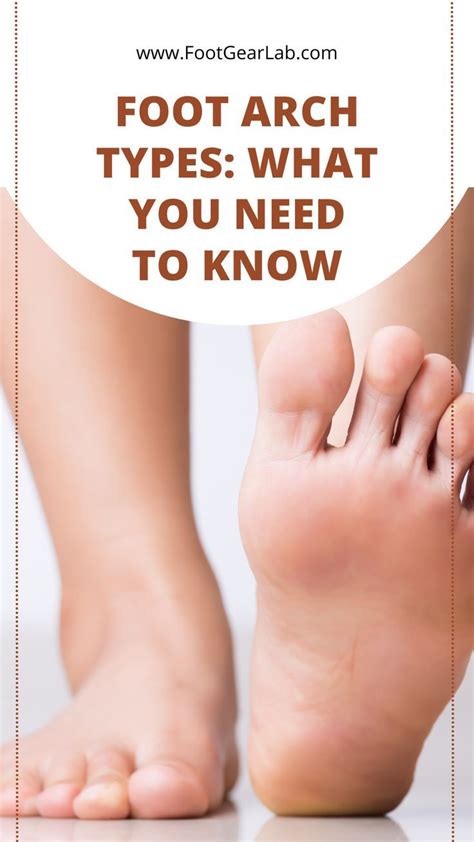 Foot arch types what you need to know – Artofit