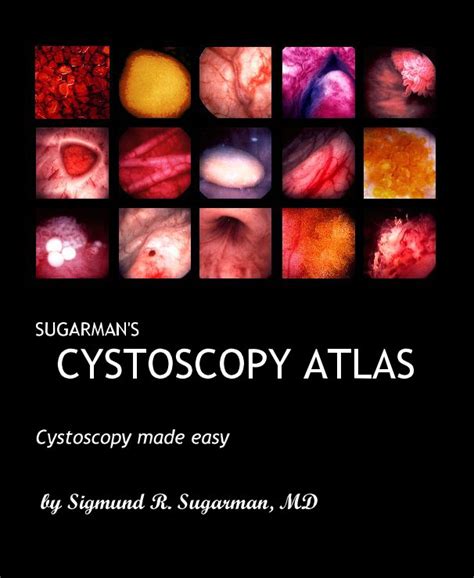 SUGARMAN'S CYSTOSCOPY ATLAS by Sigmund R. Sugarman, MD | Blurb Books