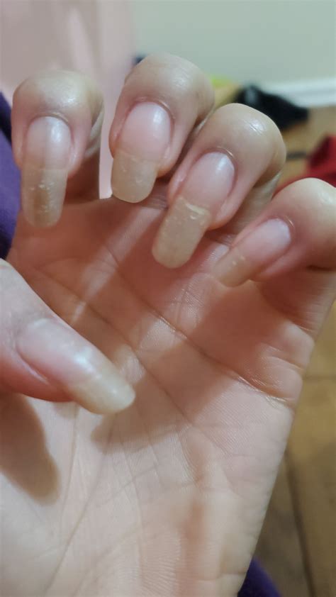 My nails look like they have scratches on it. Does anyone know how to