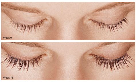 Latisse Eyelash Treatment Santa Fe NM | Eyelash Growth