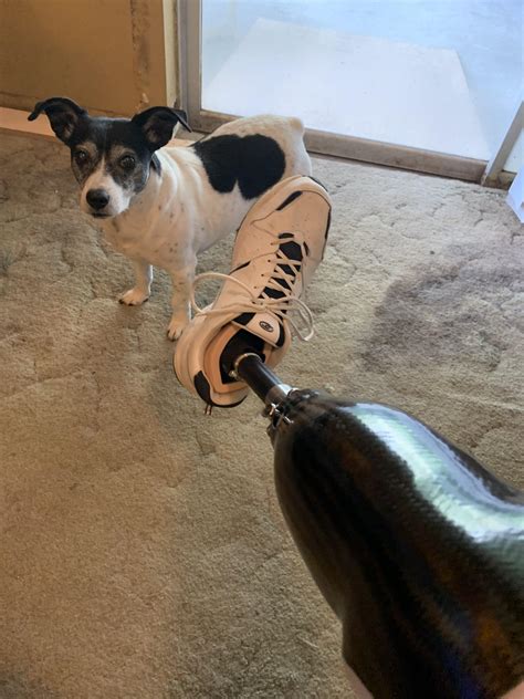 leg  foot today  wait     ramputee