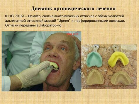 Ортопедическая стоматология. История болезни - презентация онлайн