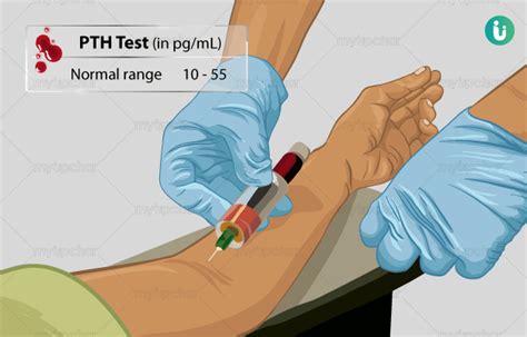 PTH (Parathyroid Hormone) Test: Procedure, Purpose, Results, Normal range, Cost, Price, Online ...