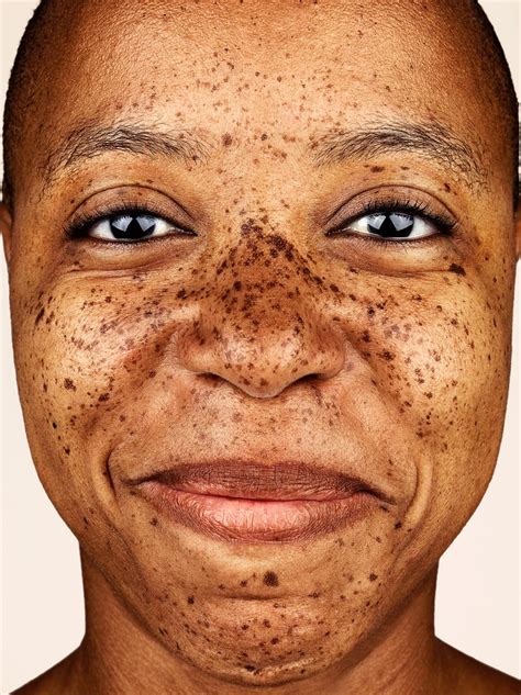 FRECKLES PHOTOGRAPHY EXHIBITION SWEDEN - BY PHOTOGRAPHER BROCK ELBANK ...