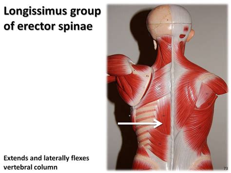 Longissimus group - Muscles of the Upper Extremity Visual … | Flickr