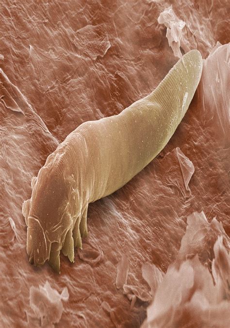 DEMODEX FOLLICULORUM MITE | buymicroart