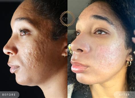 Beyond the Clicks: Katie Sigmond's Lasting Scars After the Leak - 7nspja0
