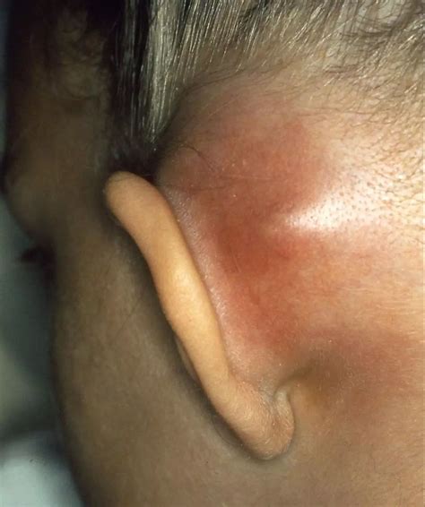 ear pathology simplemed learning medicine simplified