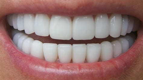 natural white teeth   minutes   teeth whitening