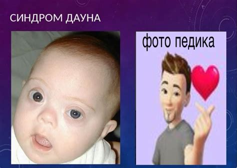 Создать мем "формы синдрома дауна, мозаичная форма синдрома дауна ...