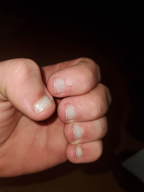 1 week. Next is 2. I recommend the nasty nail polish that taste like