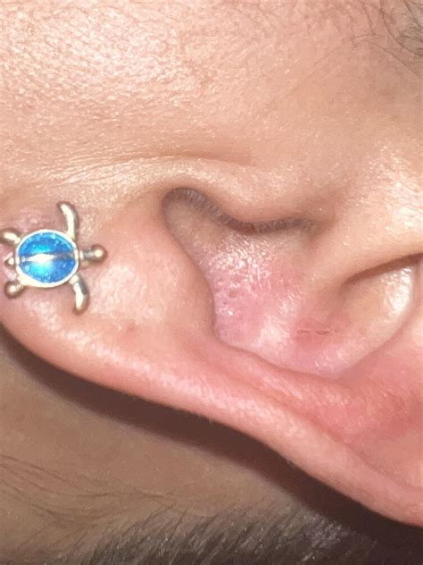 Blackhead inside of ear : r/popping