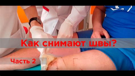Снятие швов после операции на передних крестообразных связках - YouTube