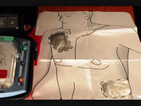 Quick AED Pads Placement - YouTube