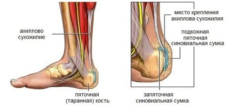 Когда болит Ахиллово Сухожилие: Причины Боли и Способы Лечения