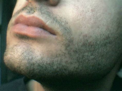 chin - Simple English Wiktionary