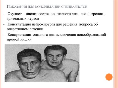 Акромегалия. Классификация - презентация онлайн