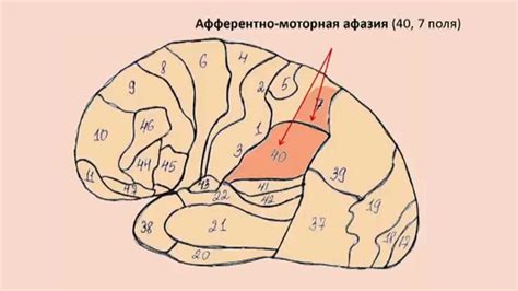 Афферентно-моторная афазия. Теоретическая часть. - YouTube