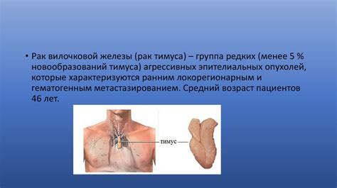 Лучевая диагностика новообразований тимуса - презентация онлайн