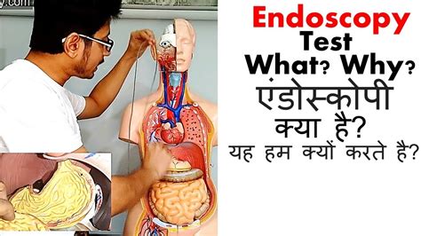 Endoscopy test in Hindi - YouTube