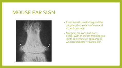 Ear signs in radiology