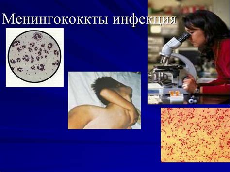 Менингококкты инфекция - презентация онлайн