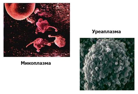 Уреаплазма (уреаплазмоз) у мужчин: симптомы и лечение, как передается ...