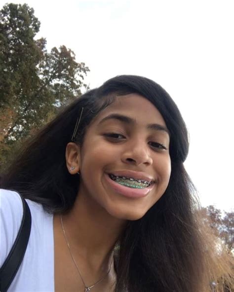 Chill & Hip Hop Showcased MiVu.photos/chill | Cute braces, Braces
