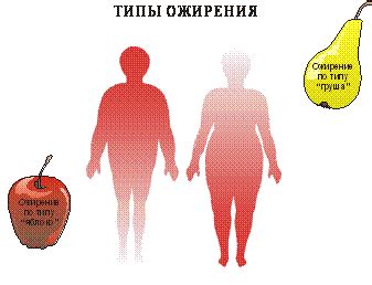 Метаболический синдром и типы ожирения | Света худеет.. и не только