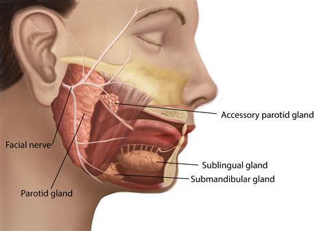 submandibular salivary gland swelling