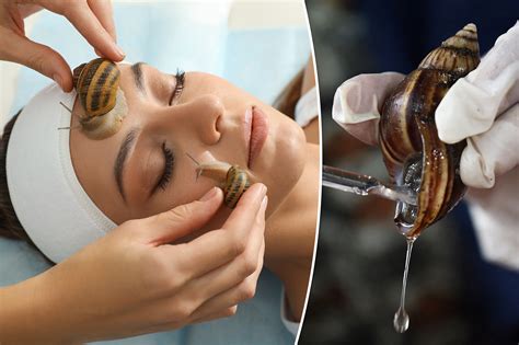 Can Snail Mucin Cause Acne? Expert Advice - SNAILS 101