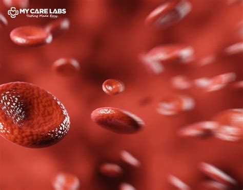 Blood Test MCV Levels: Blood Test MCV High, Low & Normal Range - My ...
